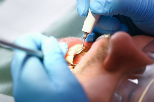 Best Cracked Tooth Emergency Dentist  in East Bronson, FL