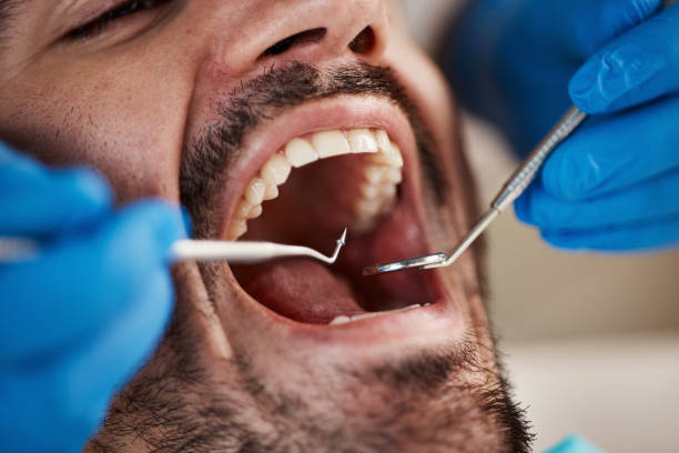 Dentist for Dental Trauma in FL